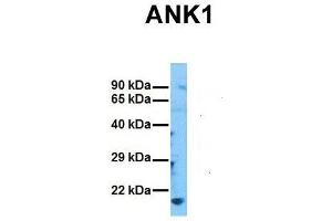 Western Blotting (WB) image for anti-Ankyrin 1, Erythrocytic (ANK1) (C-Term) antibody (ABIN2775478)
