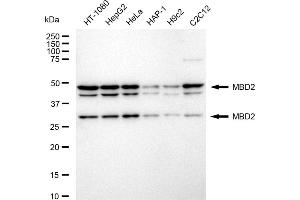 Western blotting analysis using MBD2 antibody (ABIN7799386). (Recombinant MBD2 antibody)