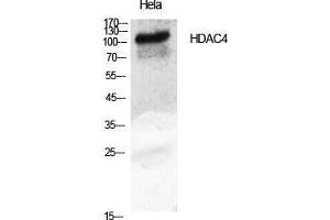 Western Blot (WB) analysis of specific cells using HDAC4 Polyclonal Antibody. (HDAC4 antibody  (Tyr493))