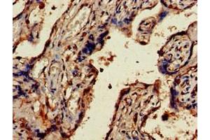 Immunohistochemistry of paraffin-embedded human placenta tissue using ABIN7174495 at dilution of 1:100 (UBE2V2 antibody  (AA 2-145))