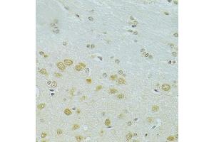 Immunohistochemistry of paraffin-embedded rat brain using RSRC1 antibody (ABIN5974341) at dilution of 1/100 (40x lens). (RSRC1 antibody)
