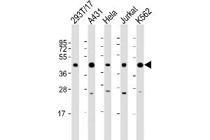 PHF6 anticorps  (AA 315-349)