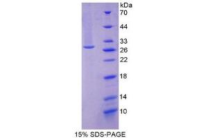 SDS-PAGE (SDS) image for Ubiquitin Carboxyl-terminal Esterase L1 (Ubiquitin Thiolesterase) (UCHL1) (AA 2-223) protein (His tag) (ABIN1878589)