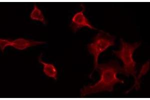 ABIN6275677 staining HepG2 by IF/ICC. (CACNG7 antibody  (Internal Region))