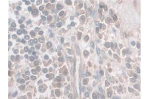 Immunohistochemistry (IHC) image for anti-Spectrin Repeat Containing, Nuclear Envelope 2 (SYNE2) (AA 6-296) antibody (ABIN7436189)