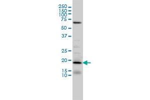 D4S234E monoclonal antibody (M01), clone 1C3 Western Blot analysis of D4S234E expression in IMR-32 . (NSG1 antibody  (AA 1-185))