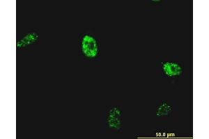 Immunofluorescence of monoclonal antibody to NKX2-5 on HeLa cell. (NK2 Homeobox 5 antibody  (AA 1-130))