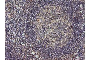 Image no. 9 for anti-Mitogen-Activated Protein Kinase Kinase 3 (MAP2K3) antibody (ABIN1499401)