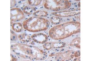 IHC-P analysis of kidney tissue, with DAB staining. (FASTK antibody  (AA 330-524))