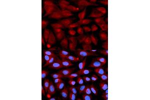 Immunofluorescence analysis of U2OS cell using CD70 antibody. (CD70 antibody)