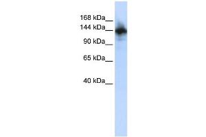 WB Suggested Anti-RBM6 Antibody Titration: 0.