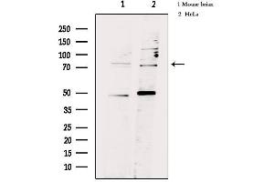 Western blot analysis of extracts from various samples, using FSHR Antibody. (FSHR antibody  (Internal Region))
