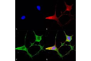 Immunocytochemistry/Immunofluorescence analysis using Mouse Anti-Ankyrin B Monoclonal Antibody, Clone S105-13 (ABIN2485082). (ANK2 antibody  (AA 203-496) (Atto 594))