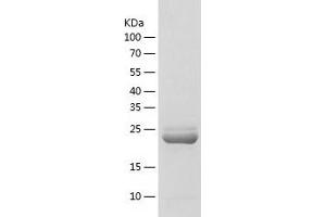 Western Blotting (WB) image for Adenylate Kinase 4 (AK4) (AA 1-223) protein (His tag) (ABIN7121720) (AK4 Protein (AA 1-223) (His tag))
