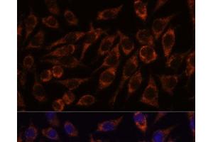 Immunofluorescence analysis of L929 cells using PYCR2 Polyclonal Antibody at dilution of 1:100. (PYCR2 antibody)
