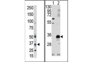 Image no. 1 for anti-Pim-1 Oncogene (PIM1) (C-Term) antibody (ABIN360327) (PIM1 antibody  (C-Term))