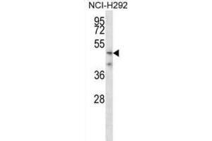 Western Blotting (WB) image for anti-Transmembrane Protease, serine 5 (TMPRSS5) antibody (ABIN2998262)