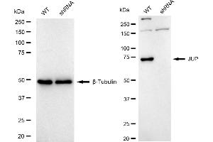 Western blotting analysis using JUP antibody (ABIN7799151). (Recombinant JUP antibody)
