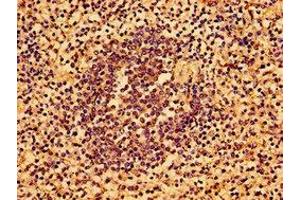 Immunohistochemistry of paraffin-embedded human spleen tissue using ABIN7143732 at dilution of 1:100 (AAGAB antibody  (AA 191-315))