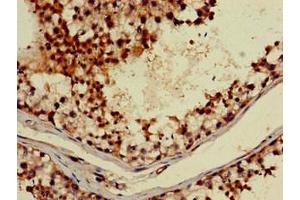 Immunohistochemistry of paraffin-embedded human testis tissue using ABIN7142928 at dilution of 1:100 (ABI2 antibody  (AA 164-452))