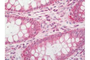 Human Colon: Formalin-Fixed, Paraffin-Embedded (FFPE). (IDH3B antibody  (Biotin))