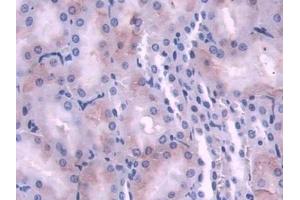 DAB staining on IHC-P; Samples: Rat Kidney Tissue (NDRG2 antibody  (AA 2-300))