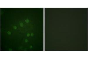 Immunofluorescence analysis of HepG2 cells, using AurB (Phospho-Thr232) Antibody. (Aurora Kinase B antibody  (pThr232))