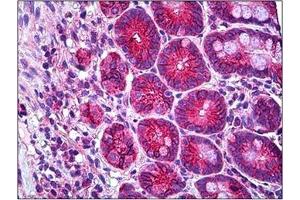 Human Small Intestine: Formalin-Fixed, Paraffin-Embedded (FFPE) (RHOH antibody  (C-Term))