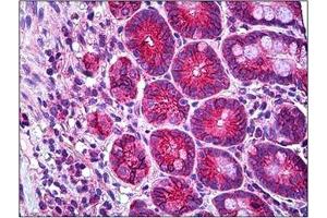 Human Small Intestine: Formalin-Fixed, Paraffin-Embedded (FFPE) (RHOH antibody  (C-Term))