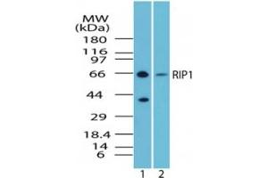 Image no. 1 for anti-Receptor (TNFRSF)-Interacting serine-threonine Kinase 1 (RIPK1) (AA 350-400) antibody (ABIN207743) (RIPK1 antibody  (AA 350-400))