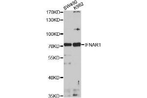 Western blot analysis of extracts of various cell lines, using IFNAR1 antibody (ABIN1873148) at 1:1000 dilution. (IFNAR1 antibody)