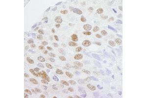 anti-Zinc Finger, CCHC Domain Containing 8 (ZCCHC8) (AA 1-50) antibody