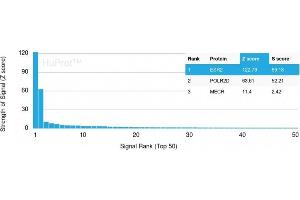 Analysis of Protein Array containing more than 19,000 full-length human proteins using Estrogen Receptor beta-1 Mouse Monoclonal Antibody (ESR2/3207) Z- and S- Score: The Z-score represents the strength of a signal that a monoclonal antibody (MAb) (in combination with a fluorescently-tagged anti-IgG secondary antibody) produces when binding to a particular protein on the HuProtTM array. (ESR2 antibody)