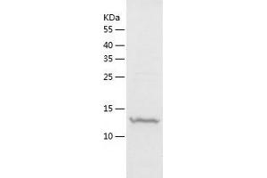 Western Blotting (WB) image for CREB Binding Protein (CREBBP) (AA 1081-1197) protein (His tag) (ABIN7288195) (CBP Protein (AA 1081-1197) (His tag))