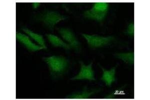 Immunostaining analysis in HeLa cells. (STAT3 antibody)