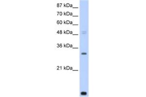 Western Blotting (WB) image for anti-CCR4-NOT Transcription Complex, Subunit 7 (CNOT7) antibody (ABIN2461842) (CNOT7 antibody)