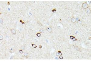 Immunohistochemistry of paraffin-embedded Rat brain using CCDC6 Polyclonal Antibody at dilution of 1:100 (40x lens). (CCDC6 antibody)