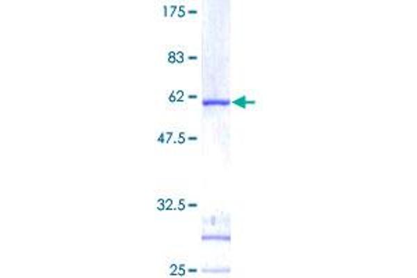 IDI1 Protein (AA 1-228) (GST tag)