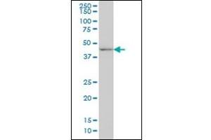 Western Blotting (WB) image for anti-Distal-Less Homeobox Protein 2 (DLX2) antibody (ABIN781967) (DLX2 antibody)