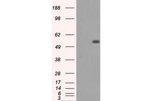 HEK293T cells were transfected with the pCMV6-ENTRY control (Left lane) or pCMV6-ENTRY FH (Right lane) cDNA for 48 hrs and lysed. (FH antibody)