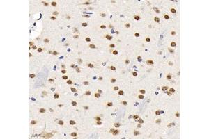 Immunohistochemistry (Paraffin-embedded Sections) (IHC (p)) image for anti-Transcription Elongation Factor A (SII)-Like 3 (TCEAL3) antibody (ABIN7075951)