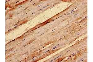 IHC analysis of paraffin-embedded human skeletal muscle tissue, using G0S2 antibody (1/100 dilution).