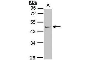 WB Image Sample(30 ug whole cell lysate) A:Hep G2 , 10% SDS PAGE antibody diluted at 1:1000 (PRMT2 antibody)