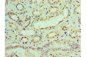 Immunohistochemistry (IHC) image for anti-Interferon-Induced Protein with Tetratricopeptide Repeats 3 (IFIT3) (AA 1-490) antibody (ABIN7156671)