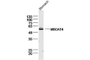 Lane 1: Mouse stomach lysates probed with Ghrelin O acyltransferase Antibody, Unconjugated (bs-13355R) at 1:300 overnight at 4˚C. (MBOAT4 antibody  (AA 101-200))