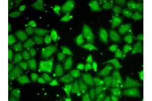 Immunofluorescence analysis of U2OS cells using MLST8 antibody (ABIN6131371, ABIN6143894, ABIN6143895 and ABIN6217660).