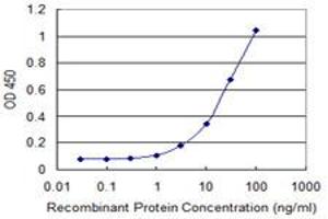 Detection limit for recombinant GST tagged FOXM1 is 0. (FOXM1 antibody  (AA 22-110))