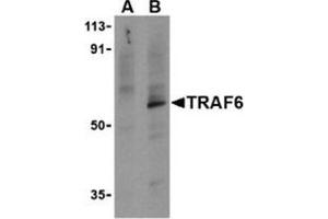 Western blot analysis of TRAF6 in PC-3 cell lysates with this product at 1 μg/ml in the presence (A) or absence (B) of 1 μg blocking peptide. (TRAF6 antibody  (C-Term))