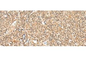 Immunohistochemistry of paraffin-embedded Human tonsil tissue using GTF2A2 Polyclonal Antibody at dilution of 1:30(x200) (GTF2A2 antibody)