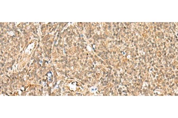 GTF2A2 antibody
